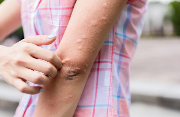 Mosquitos like to bite beer drinkers who recently had sex